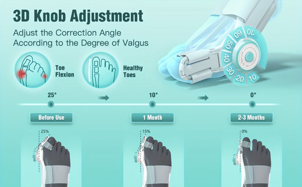 Bunion Corrector Big Toe Night Splint, Adjustable Hallux Valgus Brace with Knob & Heel Strap for Left & Right Foot, Toe Straightener for Men & Women ¨C Relieves Bunion Pain & Corrects Toe Alignment (1pc)