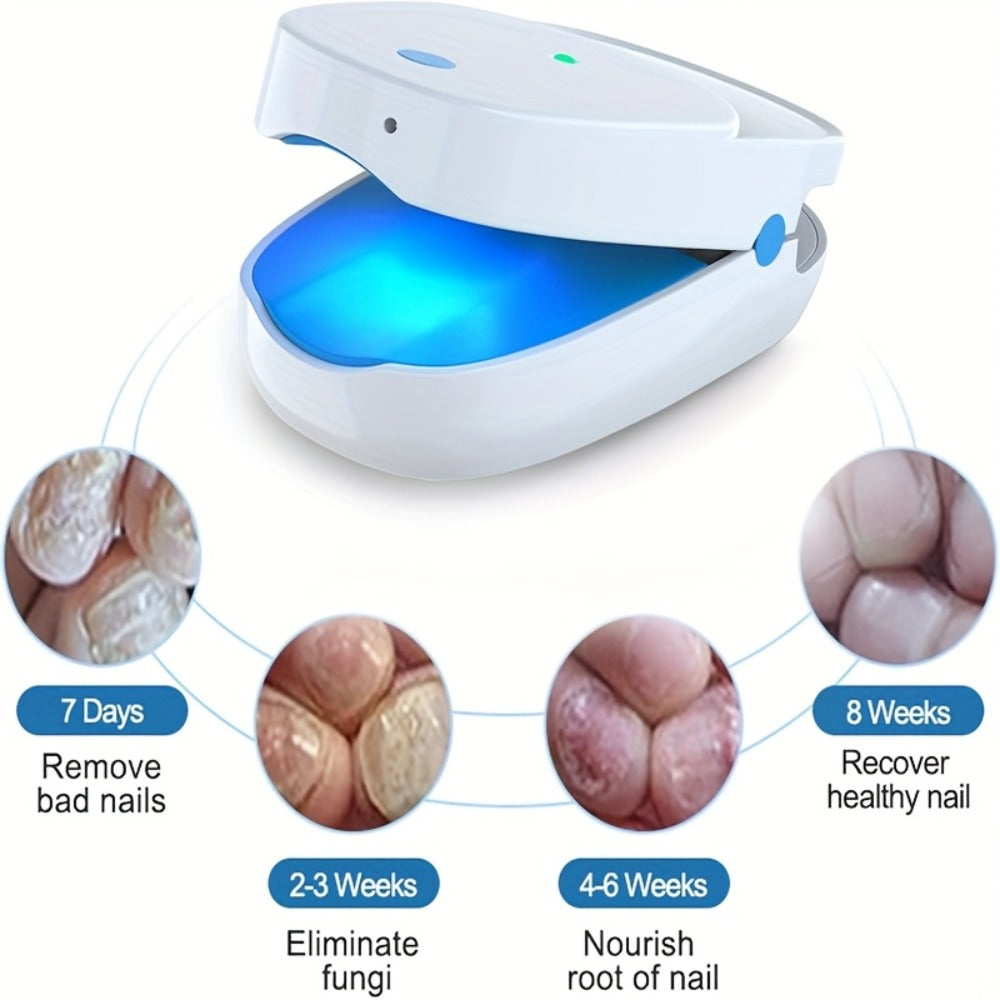 KTS Nail Fungus Laser Device FDA Cleared ¨C Extra Strength 407nm Blue Light & 905nm Dual-Light Treatment for Toenail & Fingernail Fungus, Onychomycosis Home Removal Device