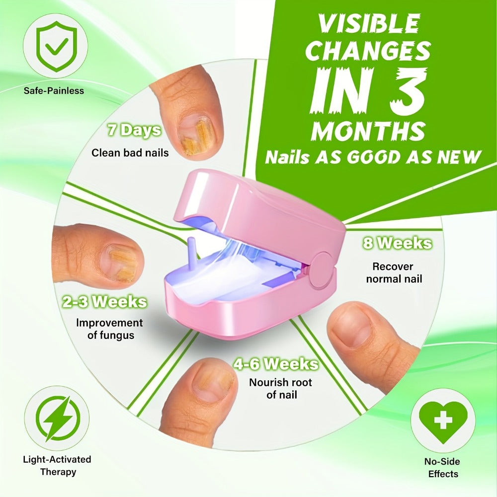 Nail Fungus Laser Treatment Device ¨C FDA Cleared Anti-Fungal Laser for Toenail & Fingernail Fungal Infections, 7-Minute Home Treatment