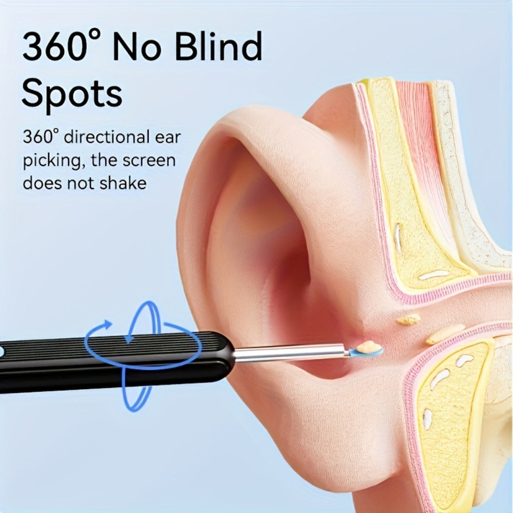Wireless Ear Camera Ear Wax Removal Kit 1080P HD 6-LED ¨C App-Controlled Visual Ear Cleaner for Adults and Pets, Compatible with All Smartphones, Multiple Cleaning Heads, Portable Ear Scoop Tool