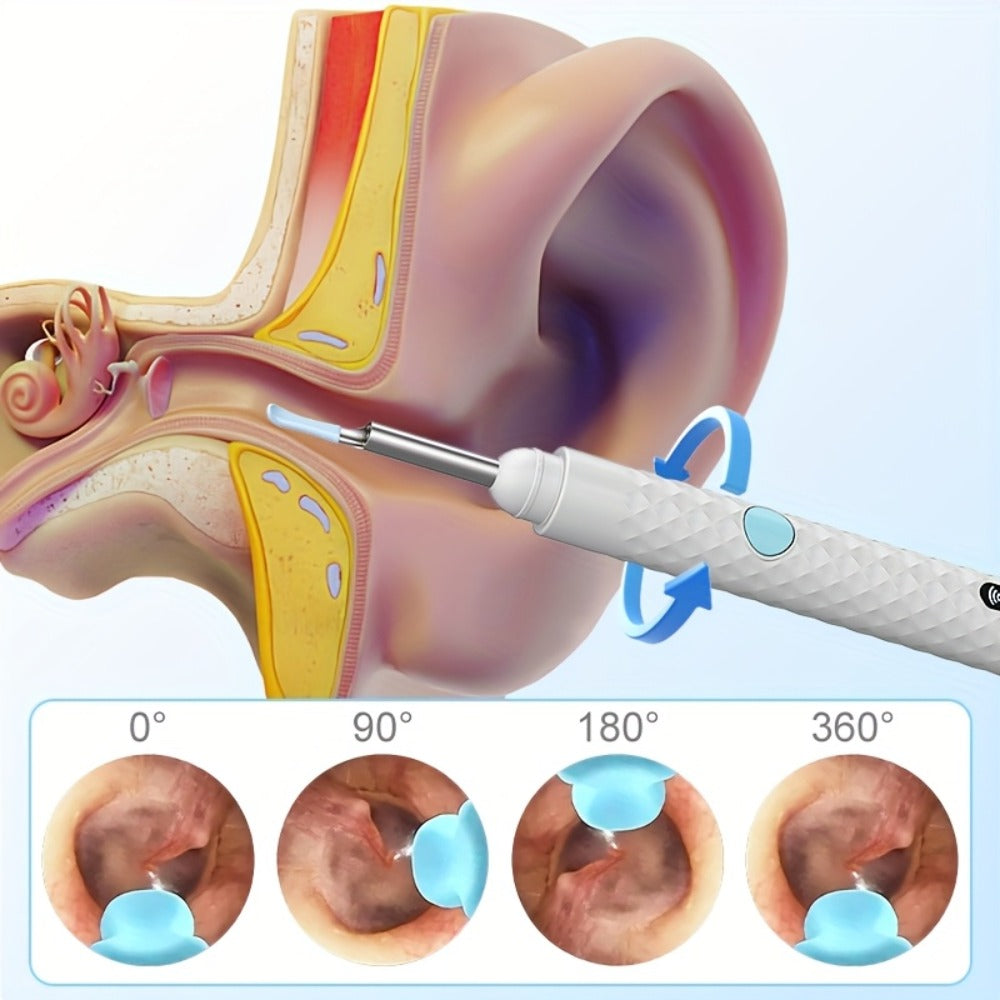 Ear Cleaning Camera Kit 1080P HD Rechargeable Lithium Battery ¨C 6 Ear Spoons, Ear Tweezers, Visual Ear Wax Removal Tool Compatible with All Smartphones for Adults Safe Home Ear Care