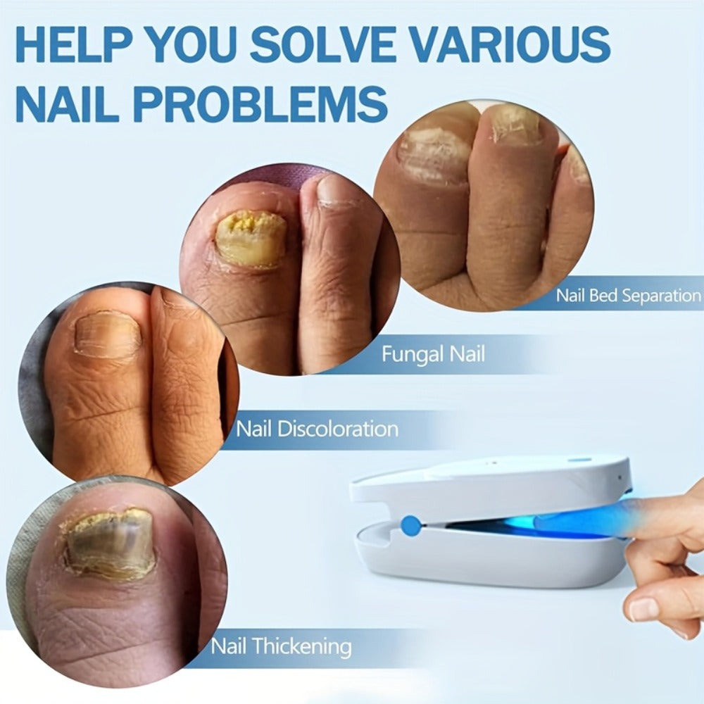 KTS Nail Fungus Laser Device FDA Cleared ¨C Extra Strength 407nm Blue Light & 905nm Dual-Light Treatment for Toenail & Fingernail Fungus, Onychomycosis Home Removal Device