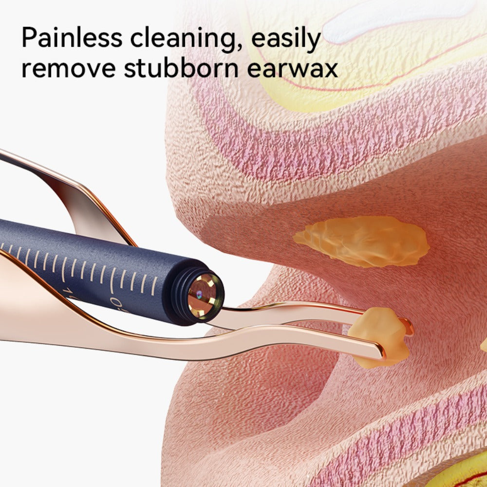 Earwax Removal Tool Set with Light & Camera ¨C Rechargeable Ear Cleaning Kit for iOS & Android, Ear Wax Remover with Otoscope