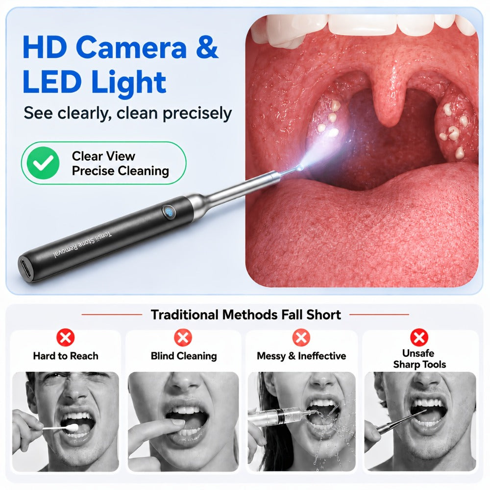Tonsil Stone Remover with Camera - 1080P HD Visual Tonsil Stone Removal Tool with LED Light, 5-in-1 Stainless Steel Tips, Wi-Fi App Control, USB-C Rechargeable, Compatible with iOS & Android