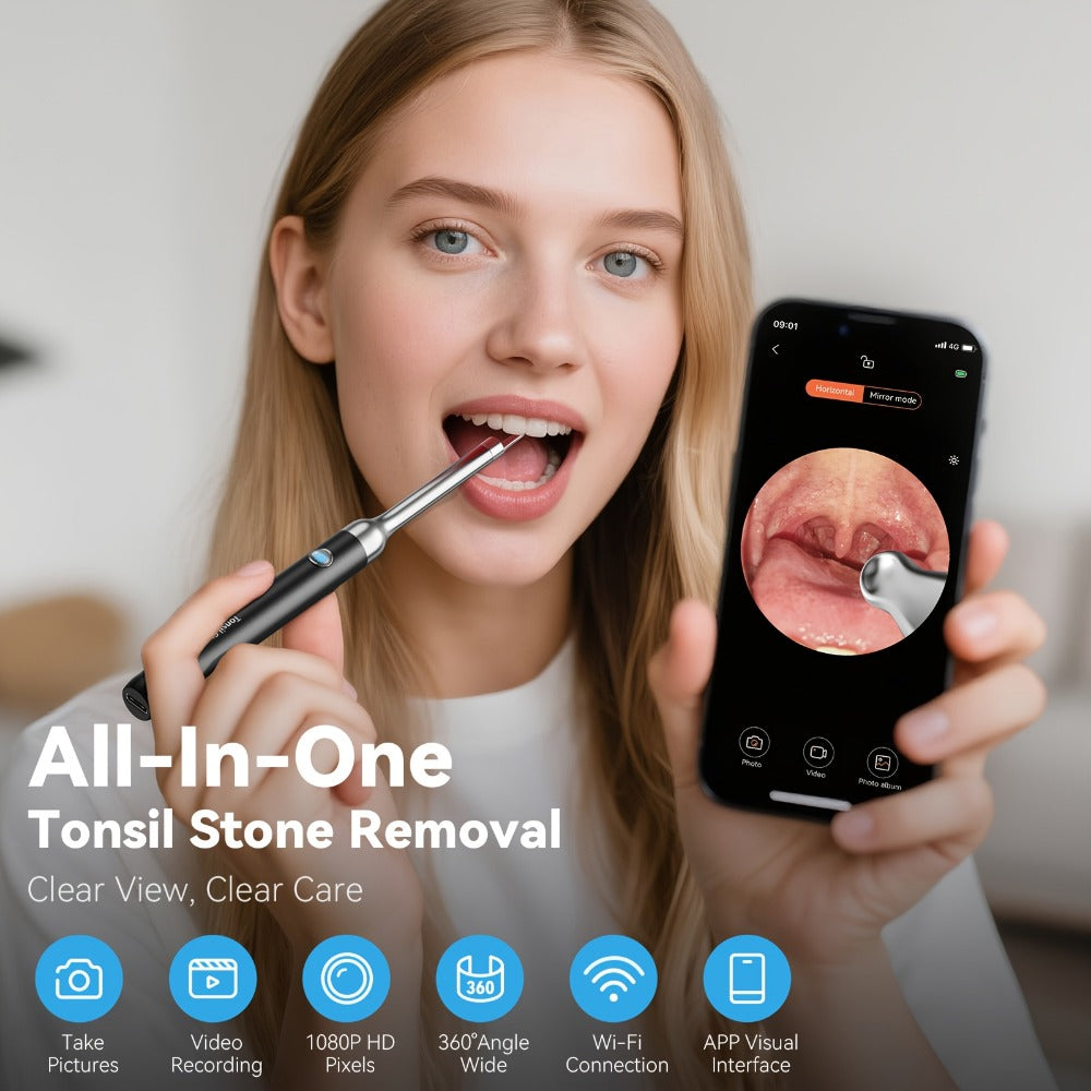 Intelligent Visual Tonsil Stone Removal Kit ¨C 1080P HD Camera, 6 LED Lights, Wi-Fi & App Connection, Multi-Accessory Oral Inspection Tool for All Ages