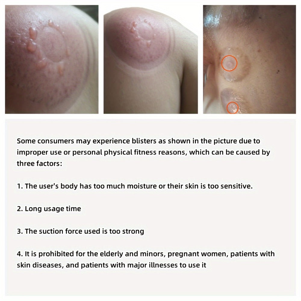 Electric Cupping Massage Device with Remote Control ¨C Neck Back Waist Shoulder Massager, 3 Modes, Hot Compress Therapy, Deep Tissue Relief