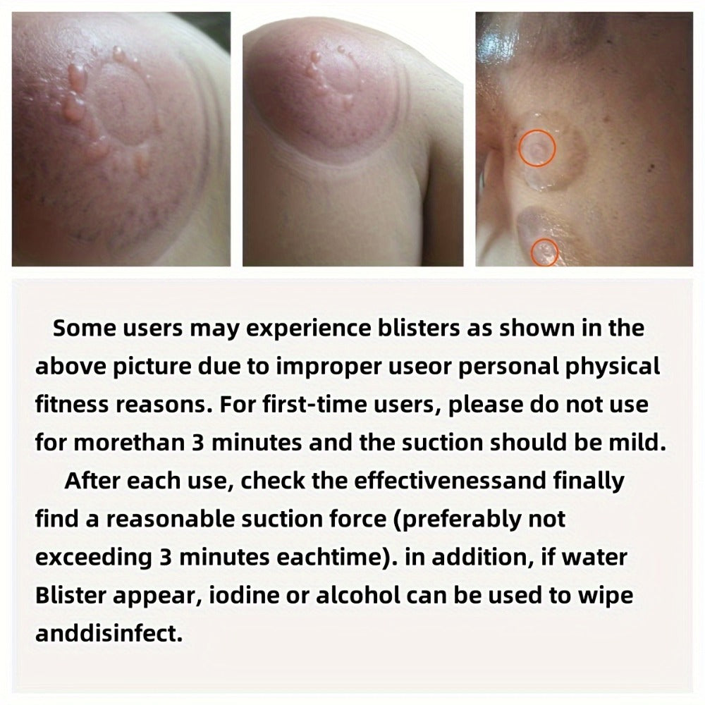 Electric Cupping Massage Device with Remote Control ¨C Neck Back Waist Shoulder Massager, 3 Modes, Hot Compress Therapy, Deep Tissue Relief