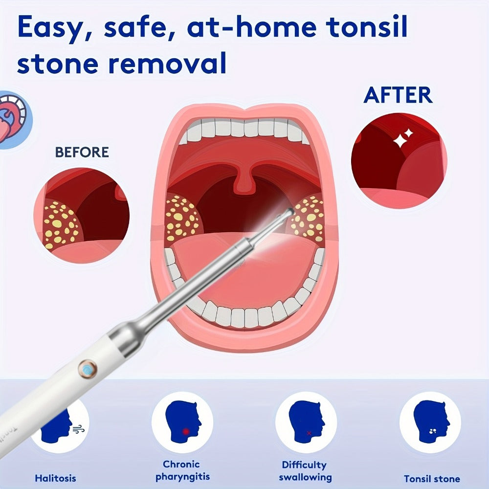 Visual Tonsil Stone Remover with 1080P HD Camera ¨C 6 LED Lights, 5 Stainless Steel Heads, Bad Breath Prevention, iOS & Android Compatible, At-Home Tonsil Care Kit