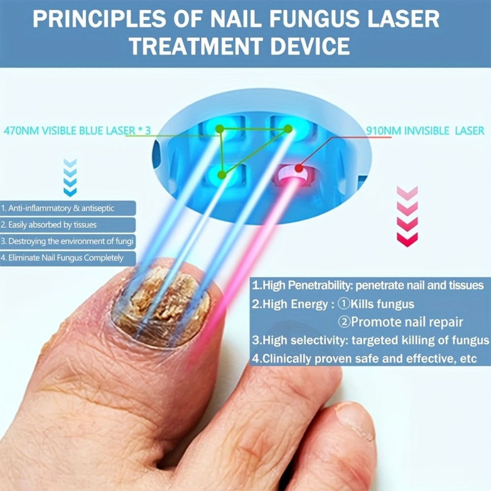 KTS Nail Fungus Laser Device FDA Cleared ¨C Extra Strength 407nm Blue Light & 905nm Dual-Light Treatment for Toenail & Fingernail Fungus, Onychomycosis Home Removal Device