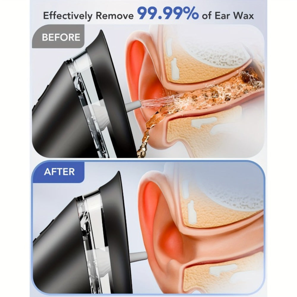 Earwax Removal Kit Pro with Visual Waste Tank ¨C Interchangeable Nozzles, USB Rechargeable Ear Cleaner for Adults, Ear Scoop & Ear Washer Options