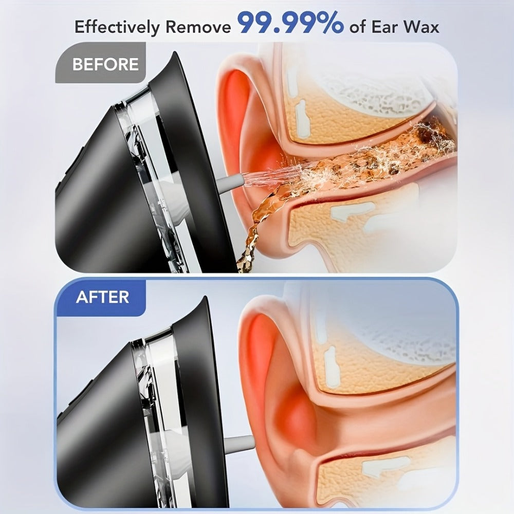 Ear Wax Removal Kit Electric Hydraulic Pro ¨C 3-Speed Water Flushing Ear Cleaner with Temp Sensor, Visual Waste Tank, USB Rechargeable, Nozzle Belt, Medical-Grade Safe Home Ear Care System
