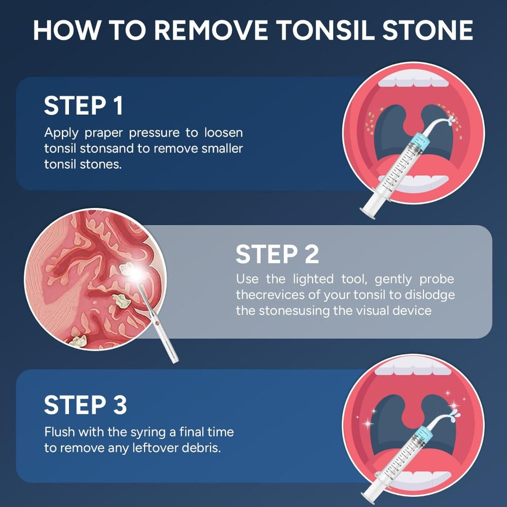 Visual Tonsil Stone Remover with 1080P HD Camera ¨C 6 LED Lights, 5 Stainless Steel Heads, Bad Breath Prevention, iOS & Android Compatible, At-Home Tonsil Care Kit