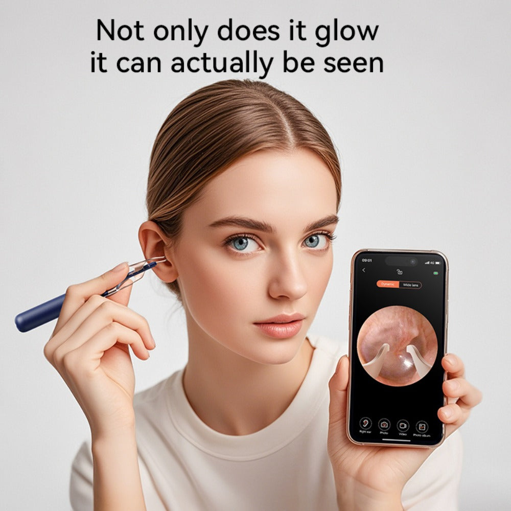 Upgraded 1080P Ear Wax Removal Tool with Camera & Storage Case ¨C LED Light, iOS & Android Compatible, Complete Ear Cleaning Kit, Holiday & Birthday Gift for Whole Family