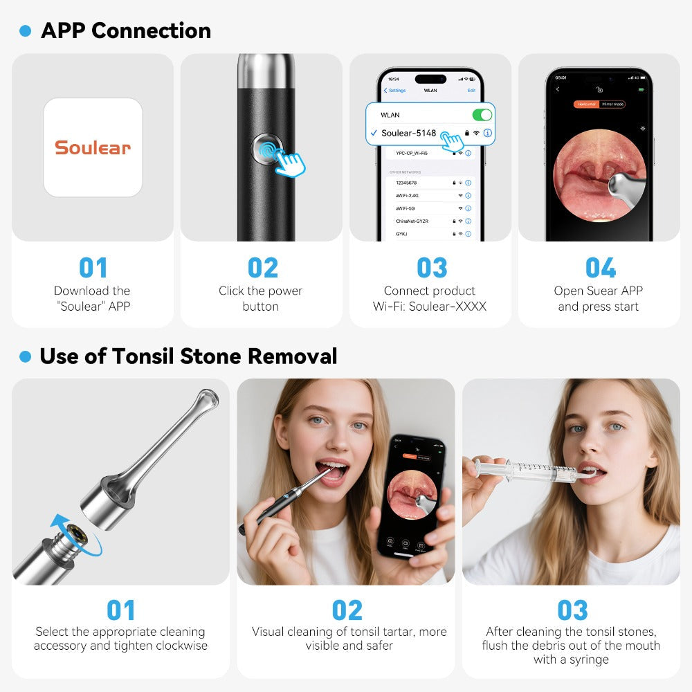 Tonsil Stone Remover with Camera 1080P HD Visual Oral Care Kit - 6 LED Lights, 5 Stainless Steel Tips, Wi-Fi App Control, USB-C Rechargeable Bad Breath Treatment Tool for iOS & Android