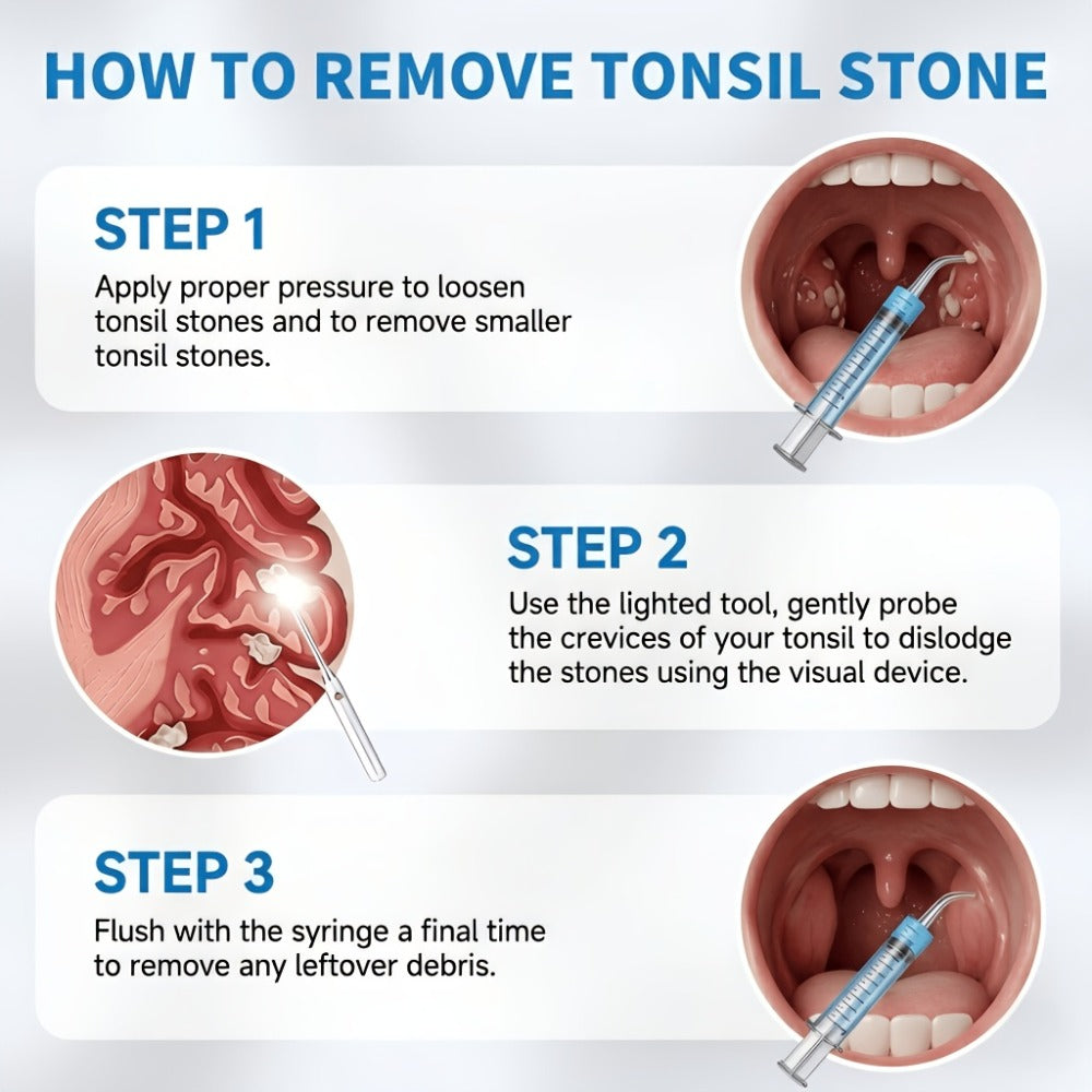 Tonsil Stone Remover with Camera - 1080P HD Visual Tonsil Stone Removal Tool with LED Light, 5-in-1 Stainless Steel Tips, Wi-Fi App Control, USB-C Rechargeable, Compatible with iOS & Android