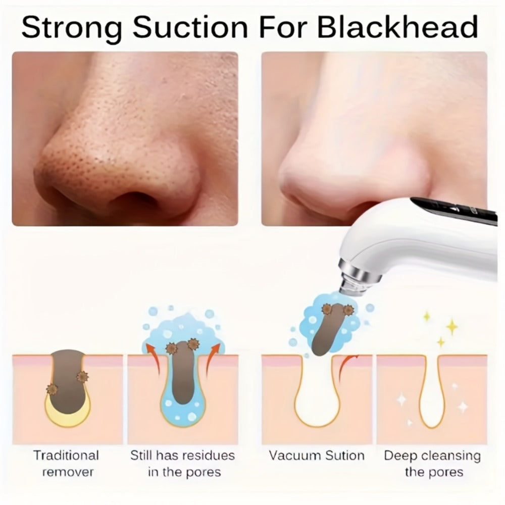 Pore Vacuum Blackhead Remover ¨C 6 Interchangeable Heads & 3 Suction Levels, USB Rechargeable Electric Pore Cleaner, Visible Deep Cleansing Facial Extractor for Men & Women, All Skin Types
