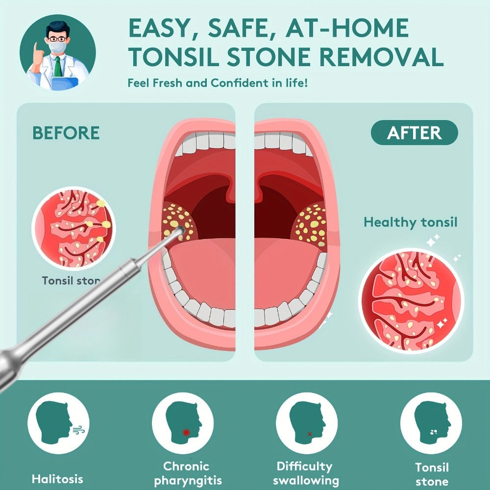 Visual Tonsil Stone Remover with 1080P HD Camera ¨C 6 LED Lights, 5 Stainless Steel Heads, Bad Breath Prevention, iOS & Android Compatible, At-Home Tonsil Care Kit