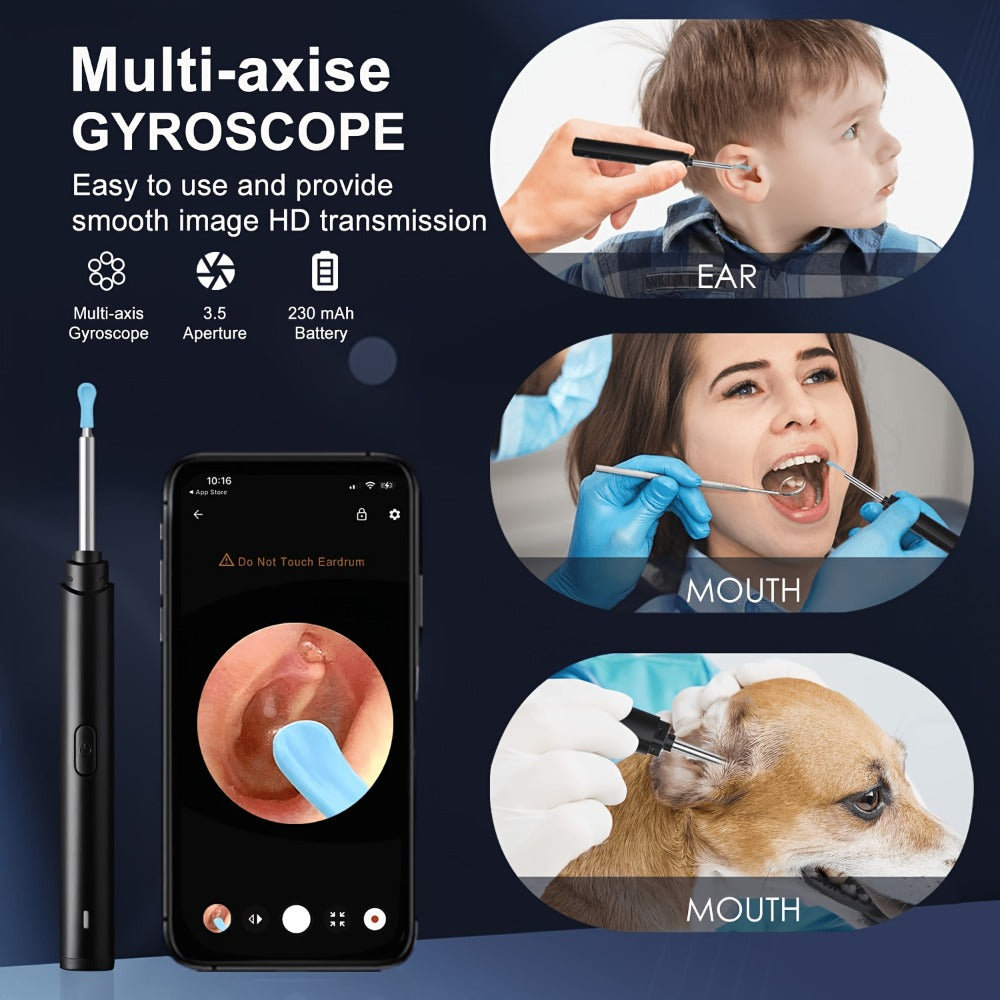 Visual Ear Pick Set 7-Piece Earwax Removal Tool with Camera and Light ¨C Ear Pick Covers Included, Compatible with All Smartphones, Safe Home Ear Cleaning Kit for Adults