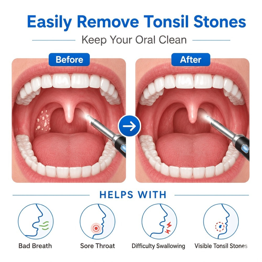 Tonsil Stone Remover with Camera - 1080P HD Visual Tonsil Stone Removal Tool with LED Light, 5-in-1 Stainless Steel Tips, Wi-Fi App Control, USB-C Rechargeable, Compatible with iOS & Android