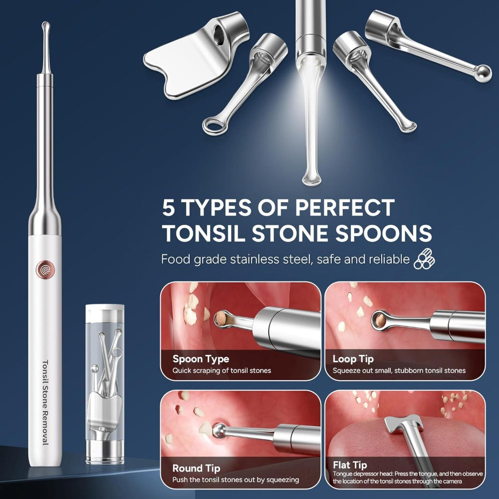 Visual Tonsil Stone Remover with 1080P HD Camera ¨C 6 LED Lights, 5 Stainless Steel Heads, Bad Breath Prevention, iOS & Android Compatible, At-Home Tonsil Care Kit