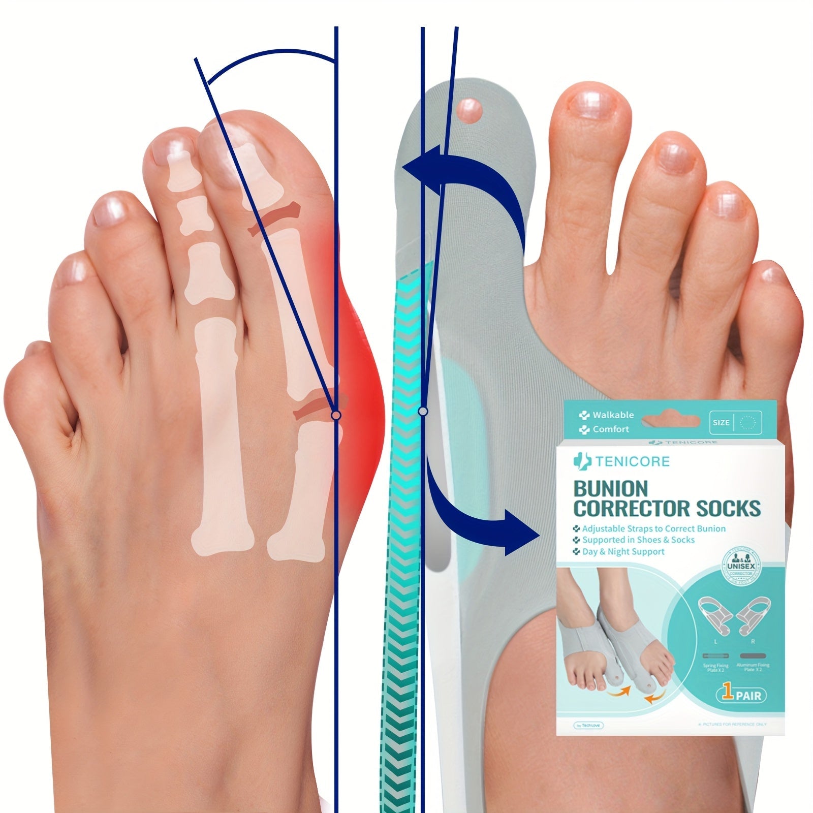 Bunion Corrector Sleeves 2-Pack ¨C 4-Point Fixation Big Toe Separator, Adjustable Day & Night Hammer Toe Straightener for Men & Women