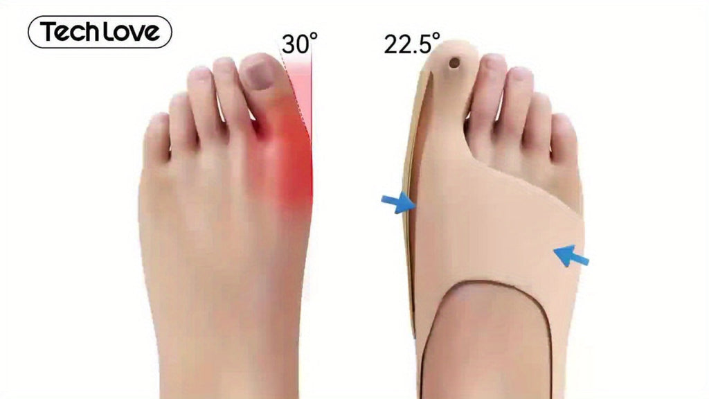 Bunion Corrector Socks Big Toe Straightener 1 Pair Adjustable Breathable Day Night Sleeve In-Shoe Hallux Valgus Correction Medium Large