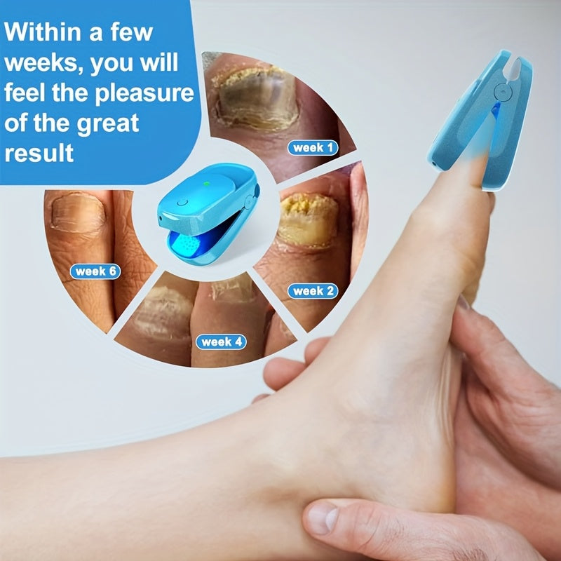 KTS Nail Fungus Laser Device FDA Cleared ¨C Extra Strength 407nm Blue Light & 905nm Dual-Light Treatment for Toenail & Fingernail Fungus, Onychomycosis Home Removal Device