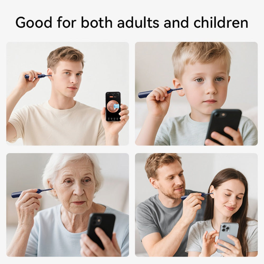 Upgraded 1080P Ear Wax Removal Tool with Camera & Storage Case ¨C LED Light, iOS & Android Compatible, Complete Ear Cleaning Kit, Holiday & Birthday Gift for Whole Family