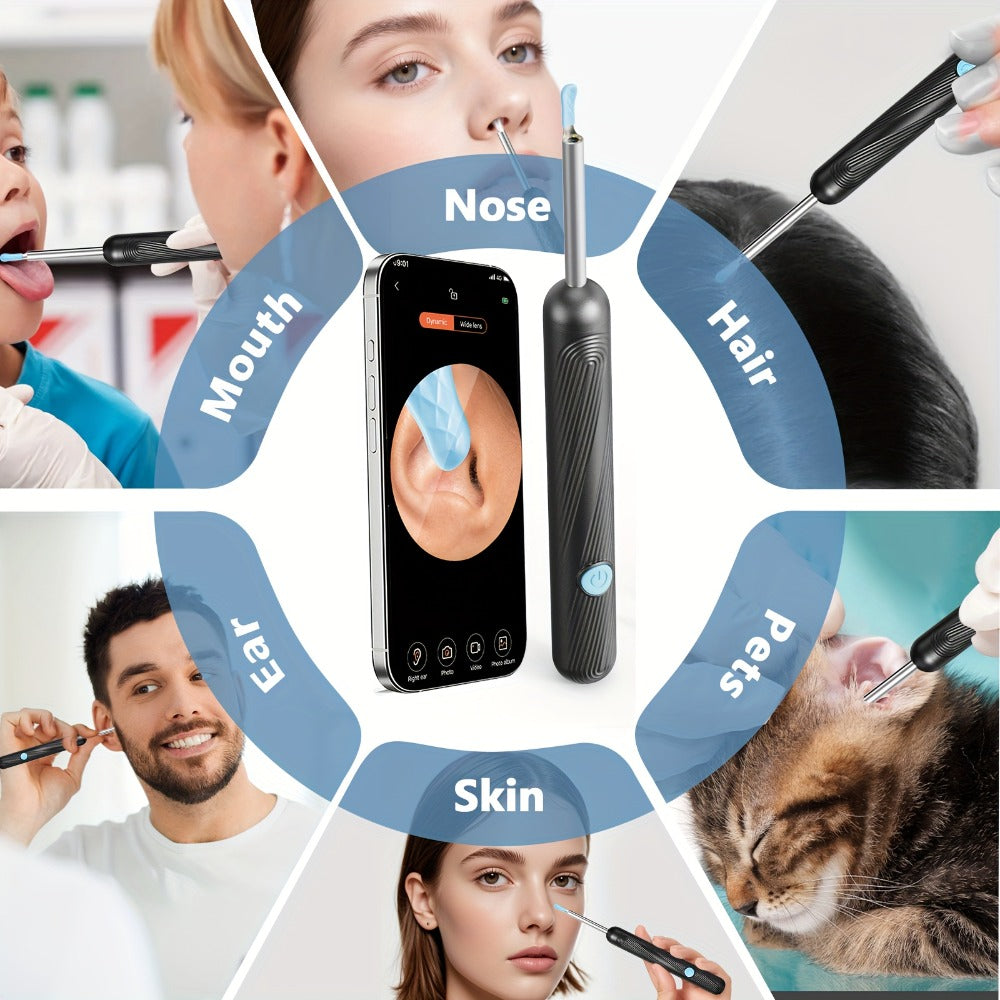 Ear Wax Removal Camera Visual Ear Cleaner 1080P HD ¨C 6 Safety Ear Spoons 7-Piece Kit, USB Charging, Real-Time Smartphone Inspection, Portable Ear Cleaning Tool for Adults Kids, Black and White