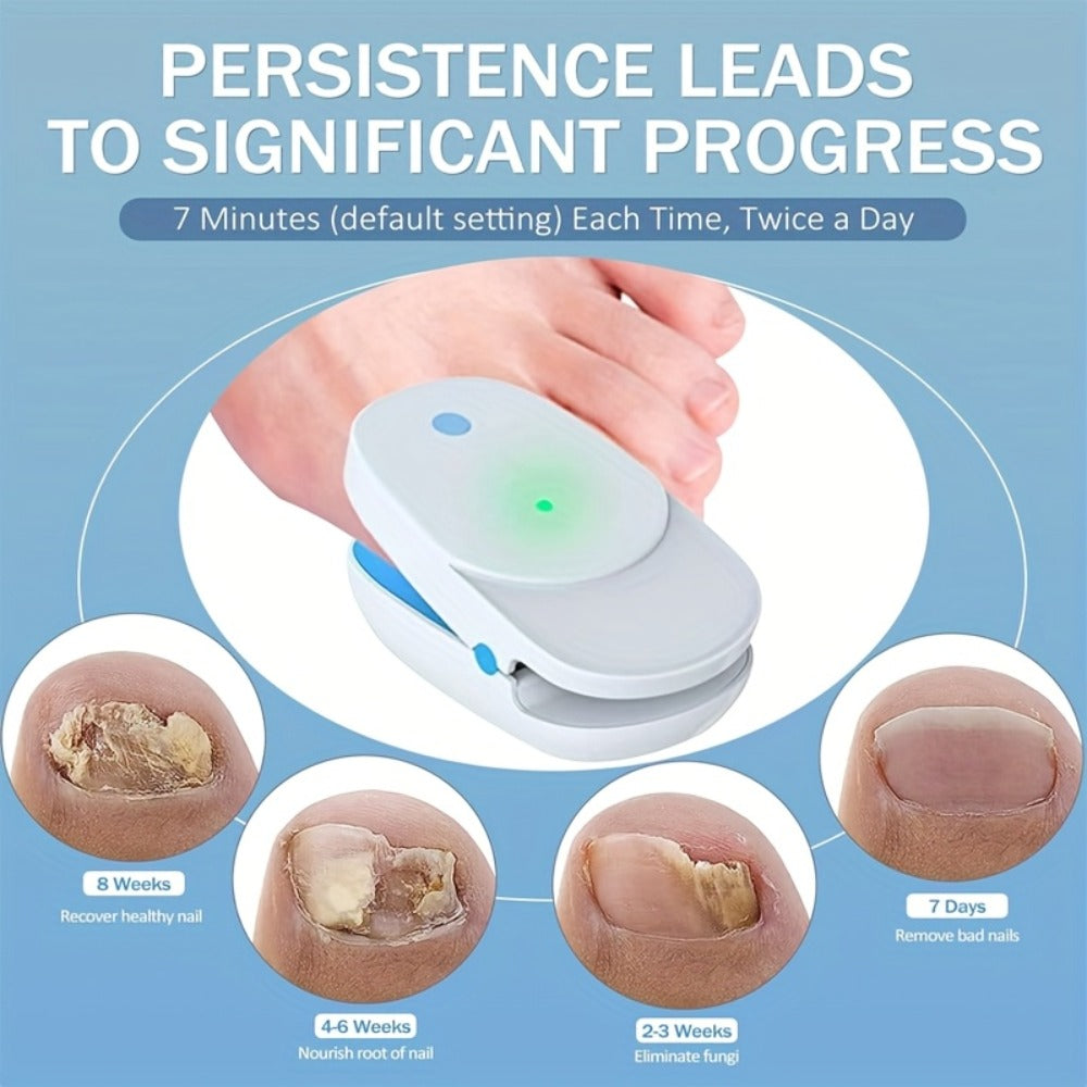 KTS Nail Fungus Laser Device FDA Cleared ¨C Extra Strength 407nm Blue Light & 905nm Dual-Light Treatment for Toenail & Fingernail Fungus, Onychomycosis Home Removal Device